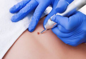Dermatology