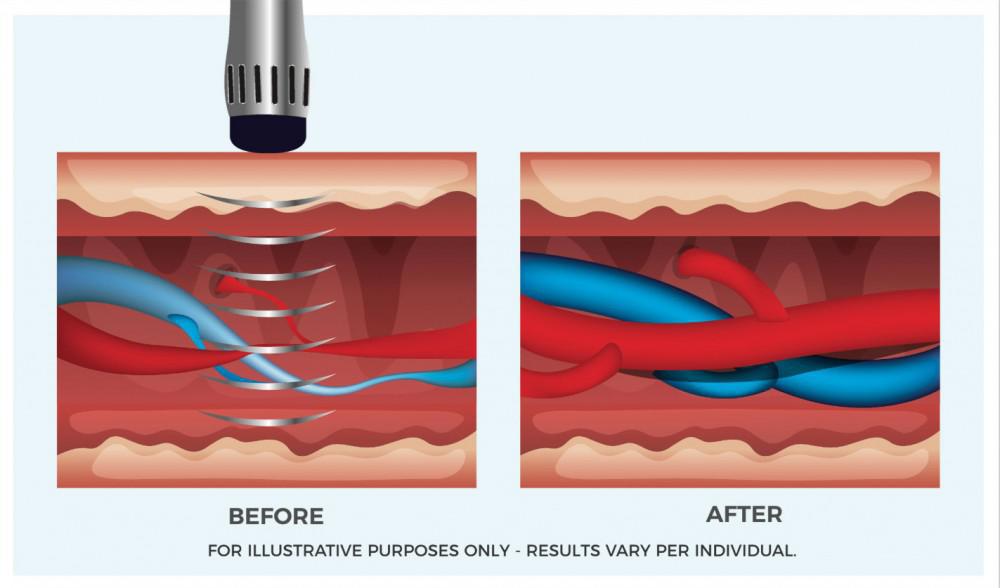 Andrology Clinic in Dubai | Erectile Dysfunction Specialist UAE