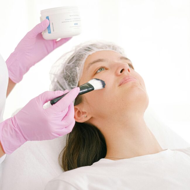 Aesthetic clinics in dubai | chemical peel